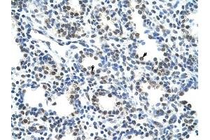 CBX3 antibody was used for immunohistochemistry at a concentration of 4-8 ug/ml to stain Alveolar cells (arrows) in Human Lung. (CBX3 anticorps  (Middle Region))