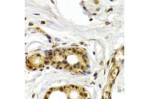 Immunohistochemistry of paraffin-embedded human mammary gland using ATF2 antibody (ABIN5971182) at dilution of 1/200 (40x lens).