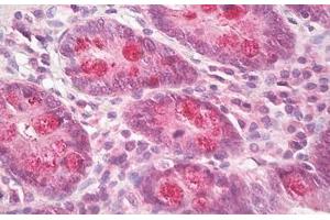 anti-Intestinal Cell (MAK-Like) Kinase (ICK) (AA 448-497) antibody