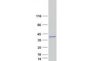 Validation with Western Blot