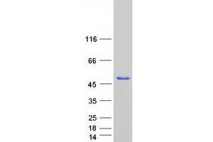 Validation with Western Blot