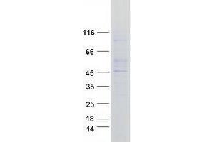 Validation with Western Blot