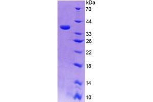 SDS-PAGE (SDS) image for Cytokine Inducible SH2-Containing Protein (CISH) (AA 1-258) protein (His tag) (ABIN6239082)