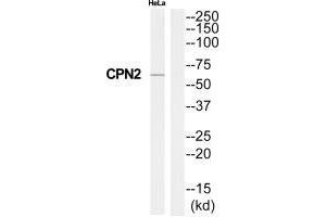 Western blot analysis of extracts from HeLa cells, using CPN2 antibody.