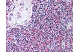 Anti-UBASH3A antibody IHC of human spleen. (UBASH3A anticorps  (AA 417-430))