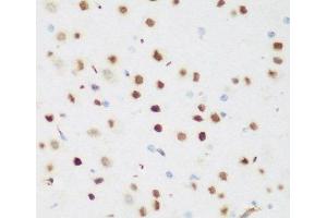 Immunohistochemistry of paraffin-embedded Mouse brain using CSRNP1 Polyclonal Antibody at dilution of 1:200 (40x lens). (AXUD1 anticorps)
