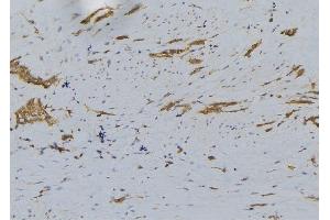 ABIN6276294 at 1/100 staining Human lung tissue by IHC-P.