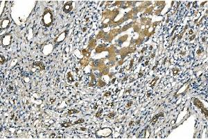IHC analysis of NLRP7 using anti-NLRP7 antibody (ABIN7599027).