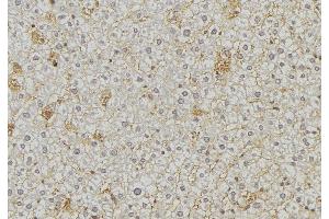 ABIN6274865 at 1/100 staining Mouse liver tissue by IHC-P. (Arylsulfatase A anticorps  (Internal Region))