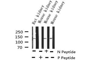 Western blot analysis of Phospho-eNOS (Ser1177) expression in various lysates