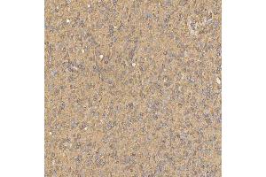 IHC analysis of SNX4 using anti-SNX4 antibody (ABIN7599406).