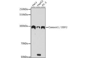 Western blot analysis of extracts of various cell lines, using Cenexin1 / ODF2 antibody (ABIN1680357, ABIN3017873, ABIN3017874 and ABIN7101531) at 1:1000 dilution. (ODF2 anticorps)