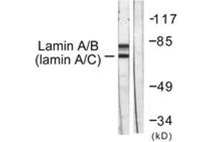Western blot analysis of extracts from HeLa cells, using Lamin A/C (Ab-392) Antibody. (Lamin A/C anticorps  (AA 361-410))