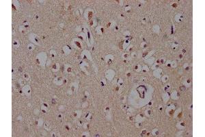 IHC image of ABIN7149488 diluted at 1:600 and staining in paraffin-embedded human brain tissue performed on a Leica BondTM system. (DACT1 anticorps  (AA 410-525))