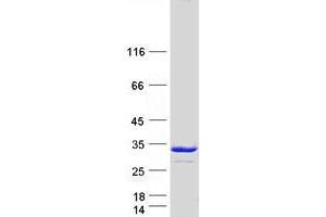 Validation with Western Blot