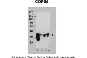 Sample Type: 1. (COPS5 anticorps  (N-Term))