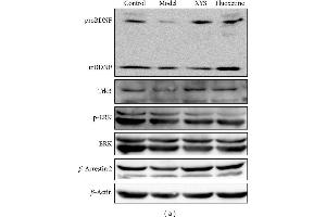 Representative Western blot analysis (a) and immunohistochemical staining (b) of BDNF, TrkB, p-ERK, ERK, and β-arrestin 2 in the hippocampus. (TRKB anticorps  (AA 401-500))