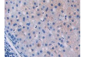 Used in DAB staining on fromalin fixed paraffin- embedded stomach tissue