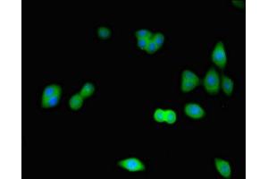 Immunofluorescence staining of HepG2 cells with ABIN7148865 at 1:266, counter-stained with DAPI. (CDK2 anticorps  (AA 1-298))