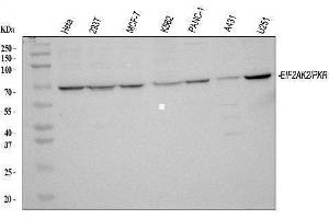 Western blot analysis of PKR/EIF2AK2 using anti-PKR/EIF2AK2 antibody (ABIN3043824).