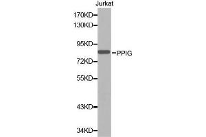 Western blot analysis of extracts of Jurkat cell line, using PPIG antibody. (PPIG anticorps  (AA 1-100))