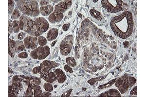 Image no. 3 for anti-Diphthamide Biosynthesis Protein 2 (DPH2) antibody (ABIN1497892)