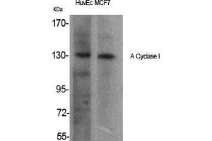 Western Blot (WB) analysis of specific cells using A Cyclase I Polyclonal Antibody.
