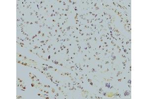 IHC analysis of RPA32/RPA2 using anti-RPA32/RPA2 antibody (ABIN7601379). (RPA2 anticorps  (AA 34-254))
