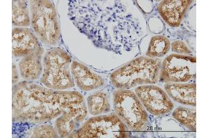 Immunoperoxidase of monoclonal antibody to BBOX1 on formalin-fixed paraffin-embedded human kidney.