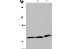 Western Blot analysis of Hela and K562 cell, Human fetal liver tissue using PGLYRP1 Polyclonal Antibody at dilution of 1:200 (PGLYRP1 anticorps)