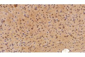 Detection of NSE in Mouse Cerebrum Tissue using Polyclonal Antibody to Enolase, Neuron Specific (NSE)