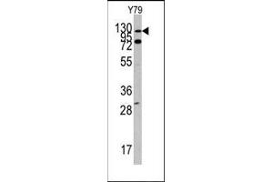 Image no. 1 for anti-C-Abl Oncogene 1, Non-Receptor tyrosine Kinase (ABL1) (N-Term) antibody (ABIN359967) (ABL1 anticorps  (N-Term))