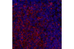 Immunofluorescence (IF) image for anti-HLA-DR (HLA-DR) antibody (ABIN7449537) (HLA-DR anticorps)