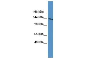 WB Suggested Anti-SLC4A5 Antibody Titration: 0. (NBC4 anticorps  (N-Term))