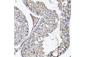 Immunohistochemistry of paraffin-embedded mouse testis using R Rabbit pAb (ABIN3017320, ABIN3017321, ABIN3017322 and ABIN6220039) at dilution of 1:200 (40x lens). (RAMP2 anticorps  (AA 1-145))