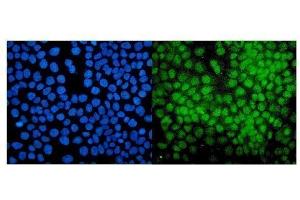 IF analysis of PIAS1 using anti-PIAS1 antibody (ABIN7602694).
