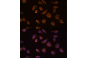 Immunofluorescence analysis of L929 cells using COMP Rabbit pAb (ABIN6127649, ABIN6138863, ABIN6138865 and ABIN6218152) at dilution of 1:100 (40x lens). (COMP anticorps  (AA 20-160))
