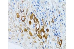 Immunohistochemistry of paraffin-embedded Human esophagus using PSRC1 Polyclonal Antibody at dilution of 1:100 (40x lens). (PSRC1 anticorps)