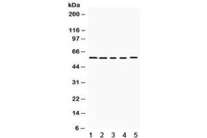 Western blot testing of 1) rat brain, 2) mouse brain, human 3) K562, 4) HeLa and 5) 22RV1 lysate with KCNA3 antibody. (KCNA3 anticorps)