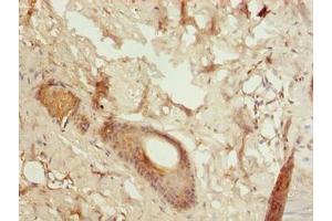 Immunohistochemistry of paraffin-embedded human skin tissue using ABIN7153448 at dilution of 1:100 (LGALS12 anticorps  (AA 1-336))