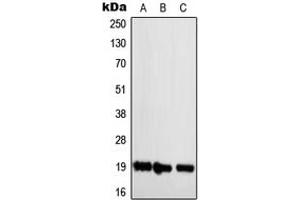 Western blot analysis of NBL1 expression in Jurkat (A), Raw264. (NBL1 anticorps  (C-Term))
