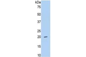 WB of Protein Standard: different control antibodies  against Highly purified E.
