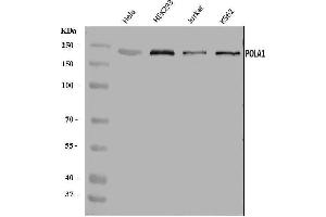 Western blot analysis of POLA1 using anti-POLA1 antibody (ABIN7601759).