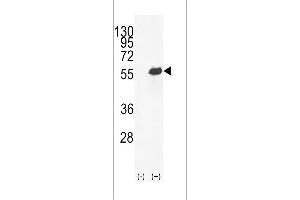 Western blot analysis of OPN-a/b (arrow) using rabbit polyclonal OPN-a/b Antibody (N-term) (ABIN655514 and ABIN2845029). (OPN-A,b (AA 14-40), (N-Term) anticorps)
