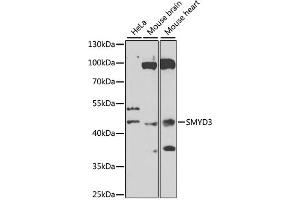 Western blot analysis of extracts of various cell lines, using SMYD3 antibody (ABIN6128709, ABIN6148169, ABIN6148170 and ABIN6223146) at 1:1000 dilution. (SMYD3 anticorps  (AA 140-369))