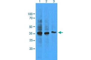 Western Blot analysis of HepG2 cell lysate (Lane 1: 1:500, Lane 2: 1:1000 and Lane 3: 1:5000) with AKR1C1 monoclonal antibody, clone AT6D10 . (AKR1C1 anticorps)