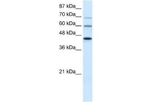 PRMT3 antibody used at 0. (PRMT3 anticorps  (Middle Region))