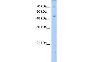 WB Suggested Anti-DPYS Antibody Titration:  2.