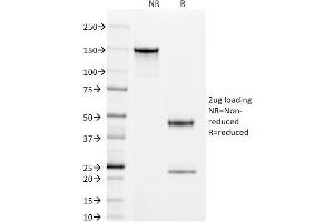SDS-PAGE Analysis Purified Superoxide Dismutase 1 Mouse Monoclonal Antibody (SOD1/2089). (SOD1 anticorps)