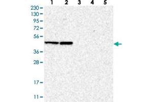 Western blot analysis of Lane 1: RT-4, Lane 2: U-251 MG, Lane 3: Human Plasma, Lane 4: Liver, Lane 5: Tonsil with BXDC5 polyclonal antibody . (RPF1 anticorps)